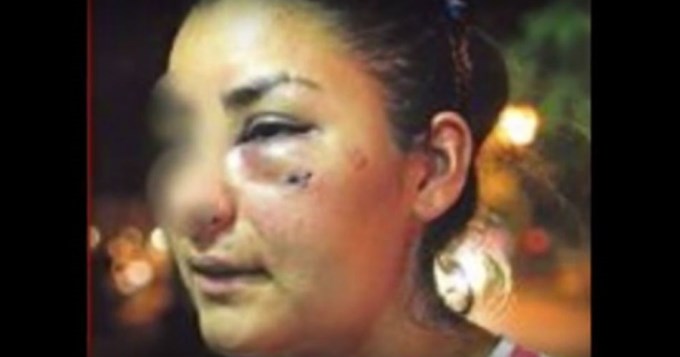 Boxeador mano larga desfigur&oacute; a golpes a su ex mujer