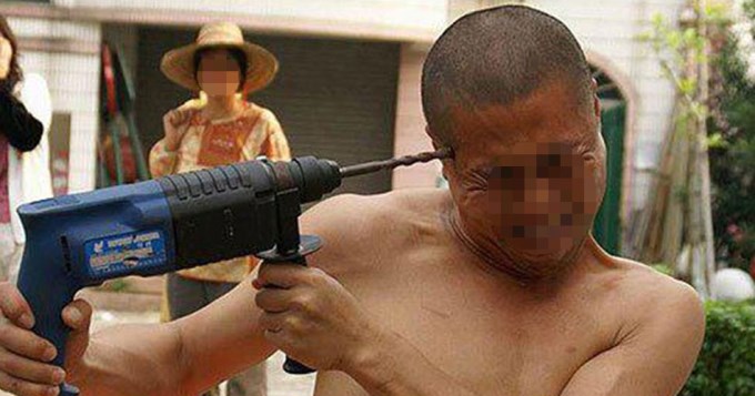 Se quiso suicidar taladr&aacute;ndose el cerebro