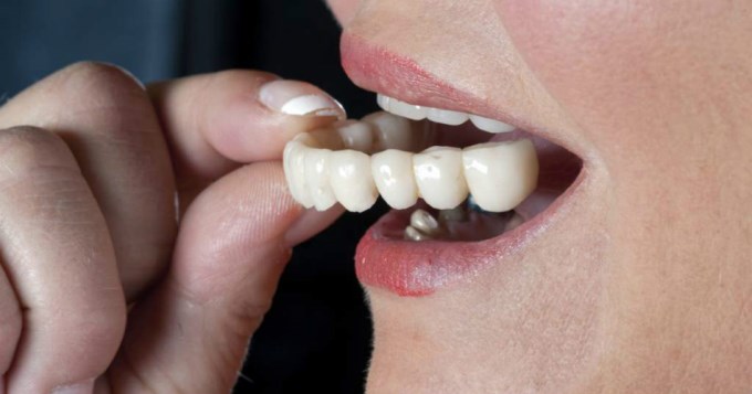 Su ex marido la golpe&oacute; y le rob&oacute; la dentadura postiza