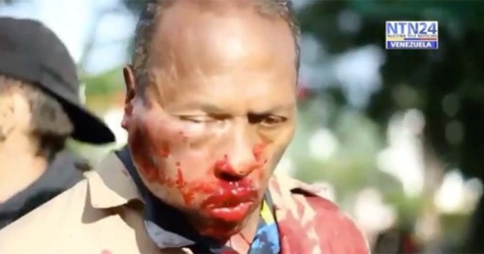 Terrible video: granada de gas lacrim&oacute;geno le destroz&oacute; la cara