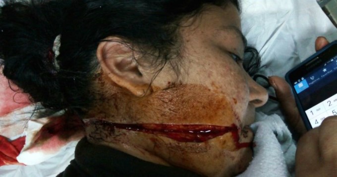 Detuvieron en Corrientes a "la loca del bistur&iacute;"