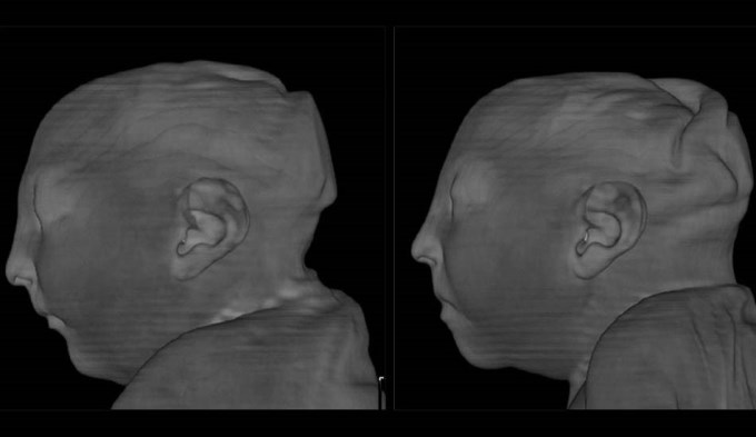 Muri&oacute; un beb&eacute; de diez d&iacute;as por Zika en Tucum&aacute;n